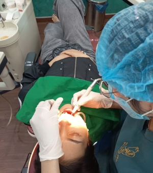 Cạo Vôi - Đánh Bóng 